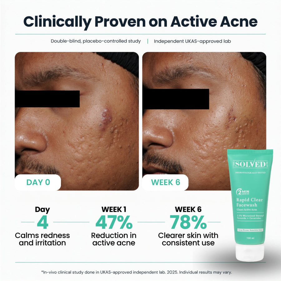 Clinical participant photographs comparing Day 0 with Week 6