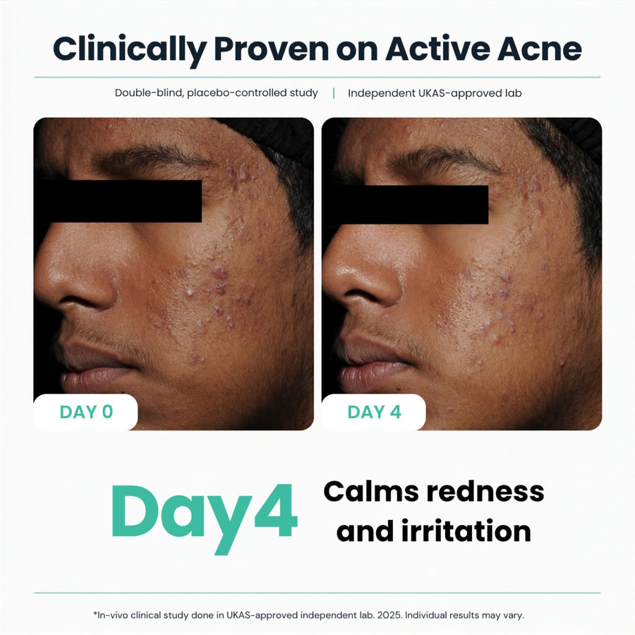 Clinical participant photographs comparing Day 0 with Day 4